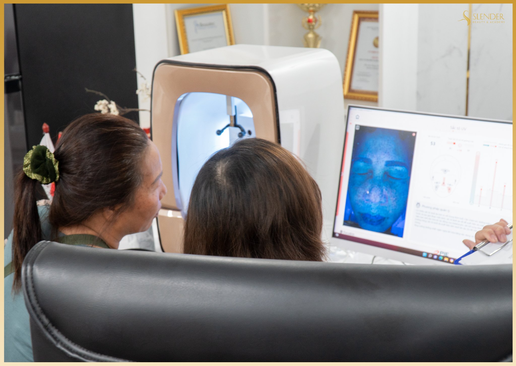 Chữa Nám Tận Gốc: Hành Trình Khôi Phục Làn Da Tại Slender Beauty