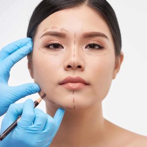 Phẫu Thuật Thẩm Mỹ